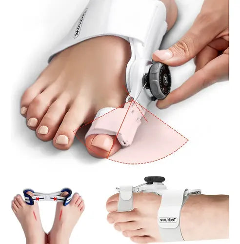 Corrector de Juanetes Ajustable