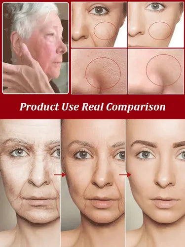 Cápsulas Antiedad SADOER 5 en 1