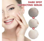 Serum de Niacinamida HOYGI