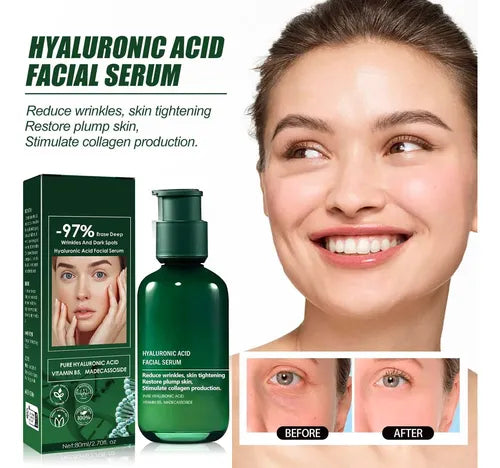 Eelhoe Sérum Facial Antiedad Hidratante con Ácido Hialurónico