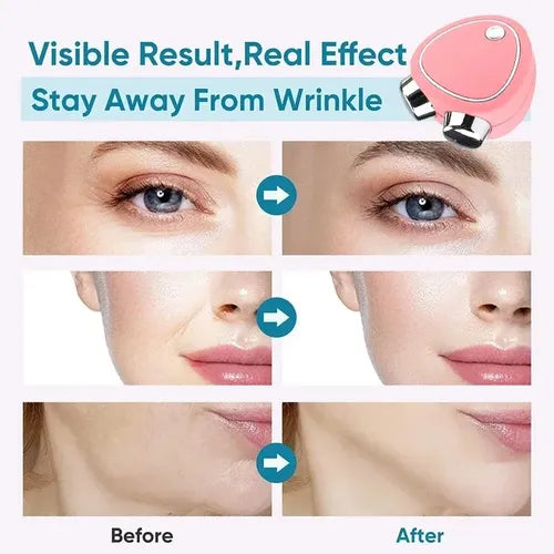 Masajeador Facial Portatil