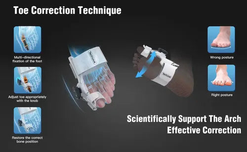 Corrector de Juanetes Ajustable
