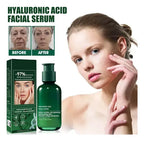 Eelhoe Sérum Facial Antiedad Hidratante con Ácido Hialurónico