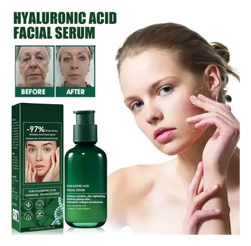 Eelhoe Sérum Facial Antiedad Hidratante con Ácido Hialurónico