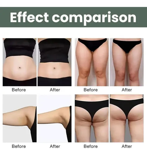 Oveallgo Crema Reafirmante Anticelulitis de Ajenjo