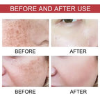 Serum de Niacinamida HOYGI