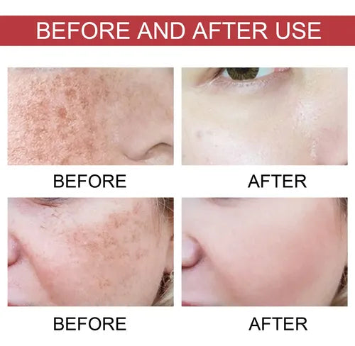 Serum de Niacinamida HOYGI