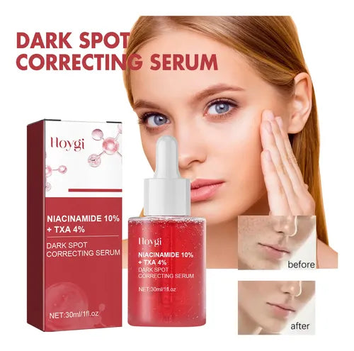 Serum de Niacinamida HOYGI