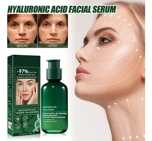Eelhoe Sérum Facial Antiedad Hidratante con Ácido Hialurónico