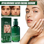 Eelhoe Sérum Facial Antiedad Hidratante con Ácido Hialurónico