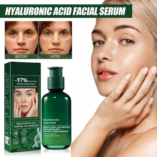 Eelhoe Sérum Facial Antiedad Hidratante con Ácido Hialurónico
