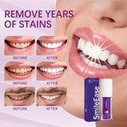 Blanqueador Dental Purpura V34