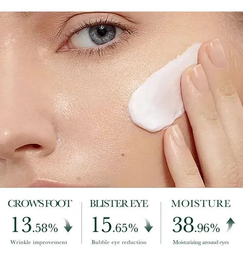 Crema Facial Control de Acne SADOER con Aceite de Arbol de Te