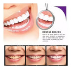 Blanqueador Dental Purpura V34