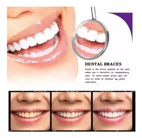 Blanqueador Dental Purpura V34
