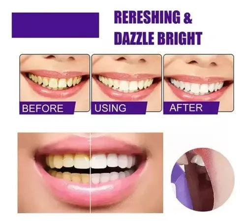 Blanqueador Dental Purpura V34