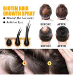 Spray Capilar Biotina 30ml