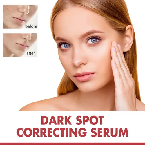 Serum de Niacinamida HOYGI