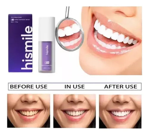 Blanqueador Dental Purpura V34
