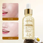 Esencia Facial Calmante e Hidratante