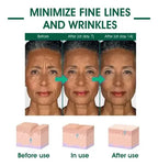 Eelhoe Sérum Facial Antiedad Hidratante con Ácido Hialurónico