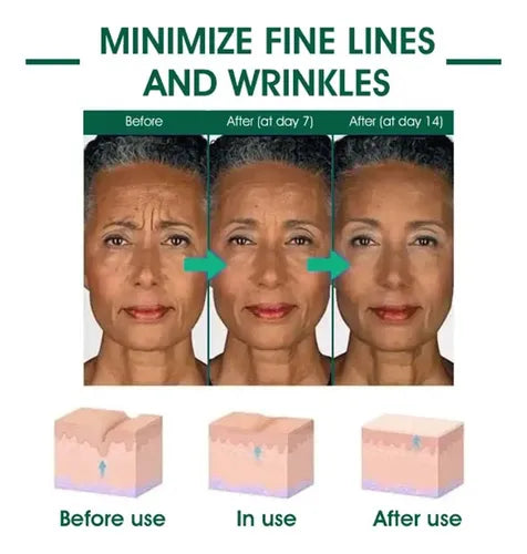 Eelhoe Sérum Facial Antiedad Hidratante con Ácido Hialurónico