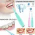 Limpieza Dental Ultrasonico