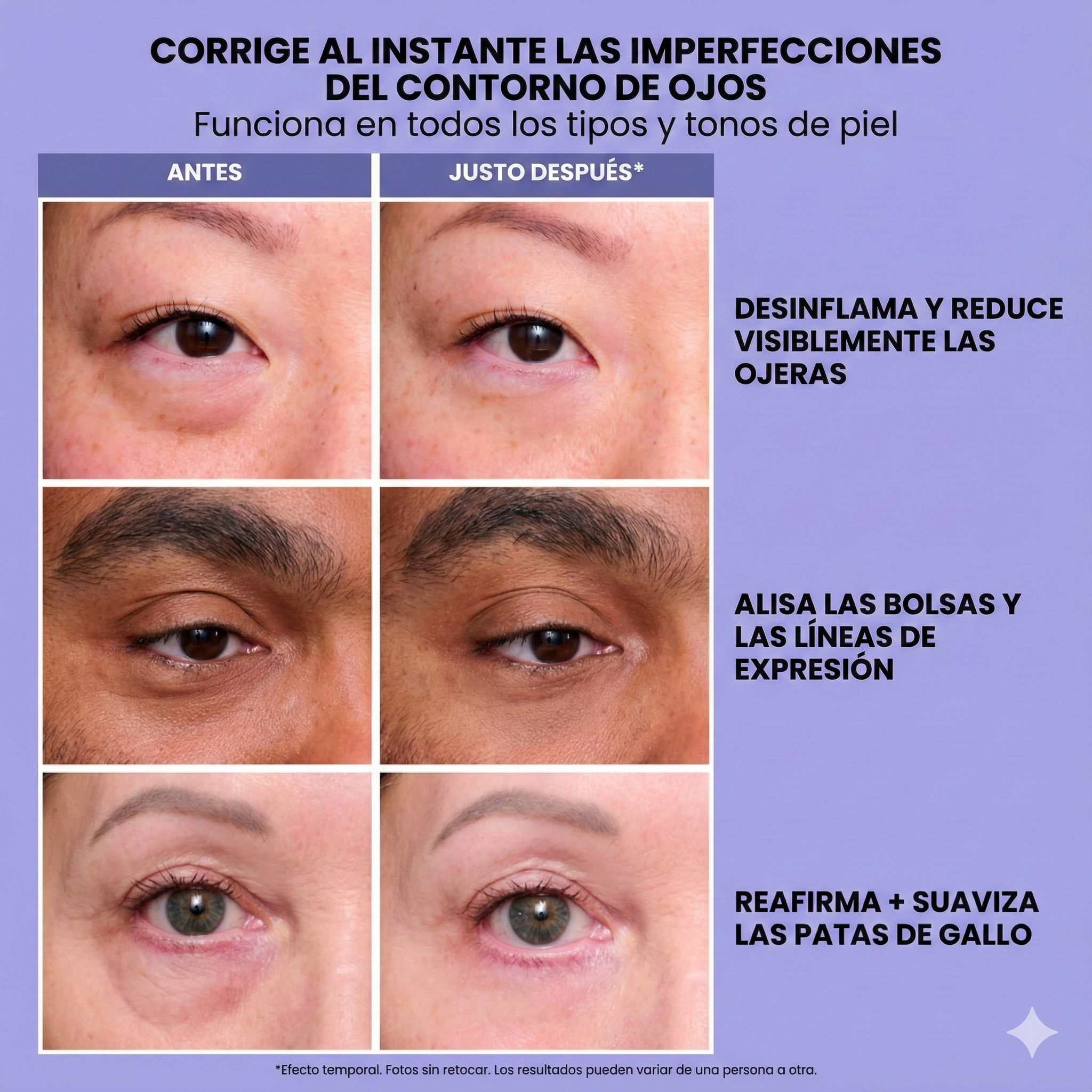 InfiniteLift | Gel tensor rejuvenecedor para los ojos