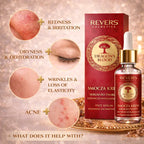 Sérum Regenerador Facial con Sangre de Dragón