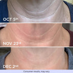 Crema Anti-Edad para Cuello y Escote