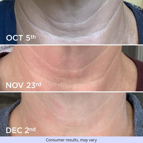 Crema Anti-Edad para Cuello y Escote