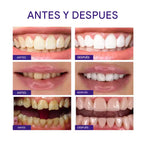 Blanqueador Dental V34 Formula Purpura