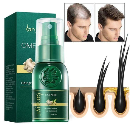 ShougaGRO Spray Capillare con Estratto di Zenzero