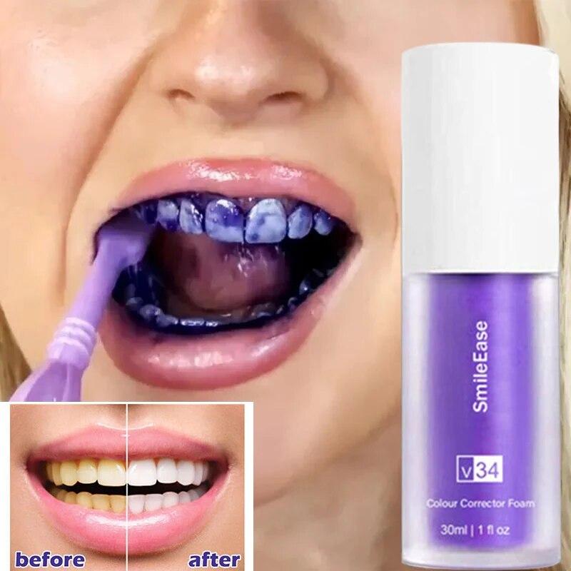 Purple Teeth Whitening