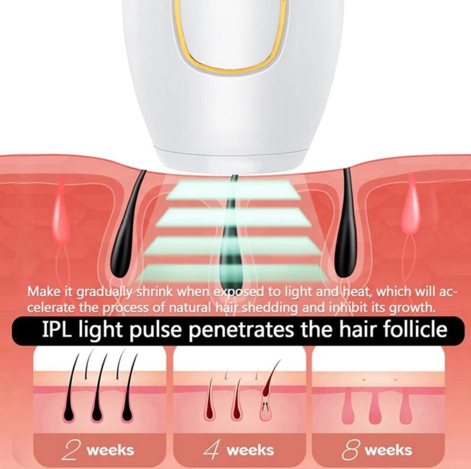 Depiladora Laser IPL Profesional para el Hogar