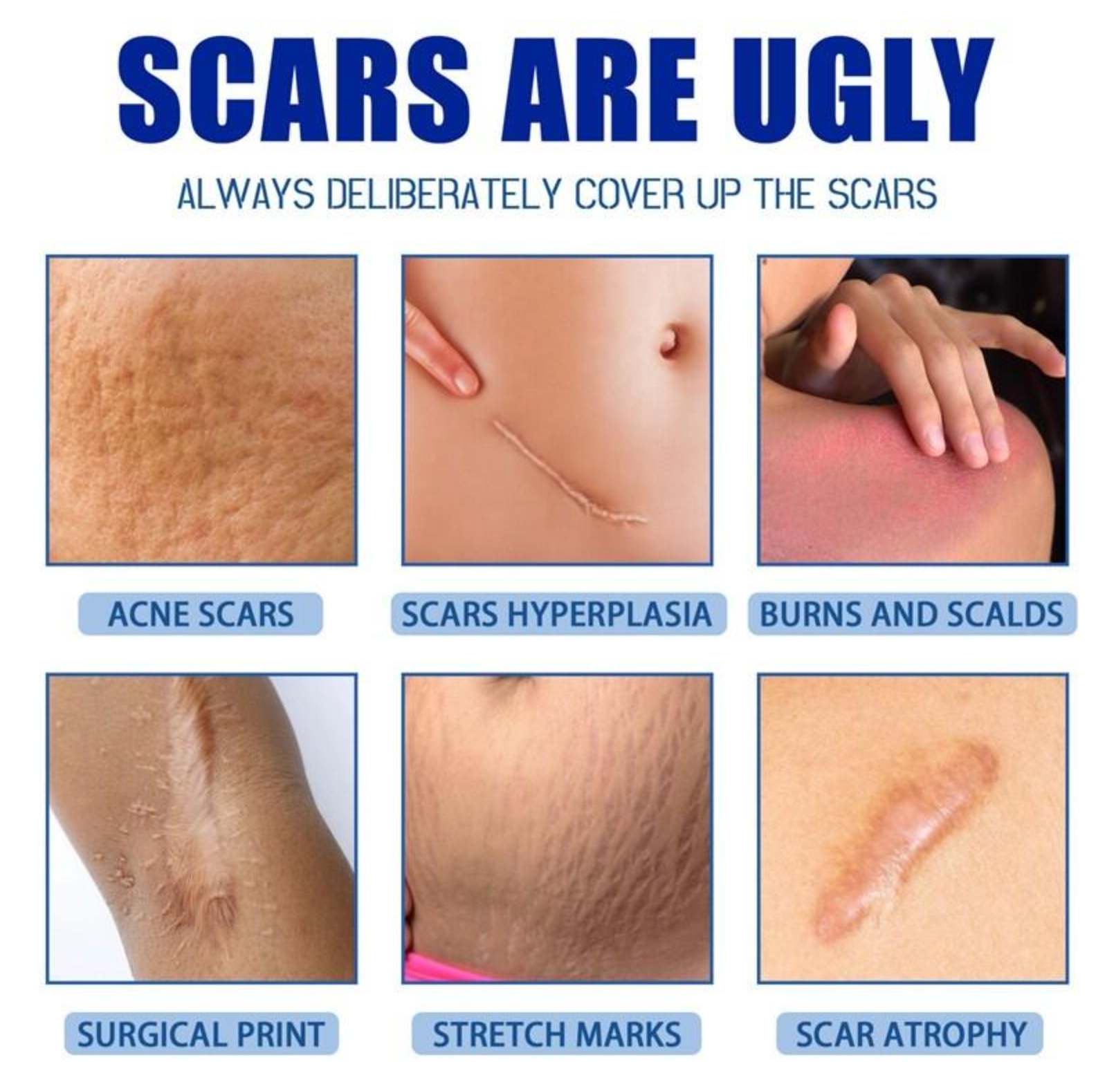 ✨ JAYSUING Scar Removal Cream 30g