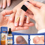 Serum de Veneno de Abeja para Uñas