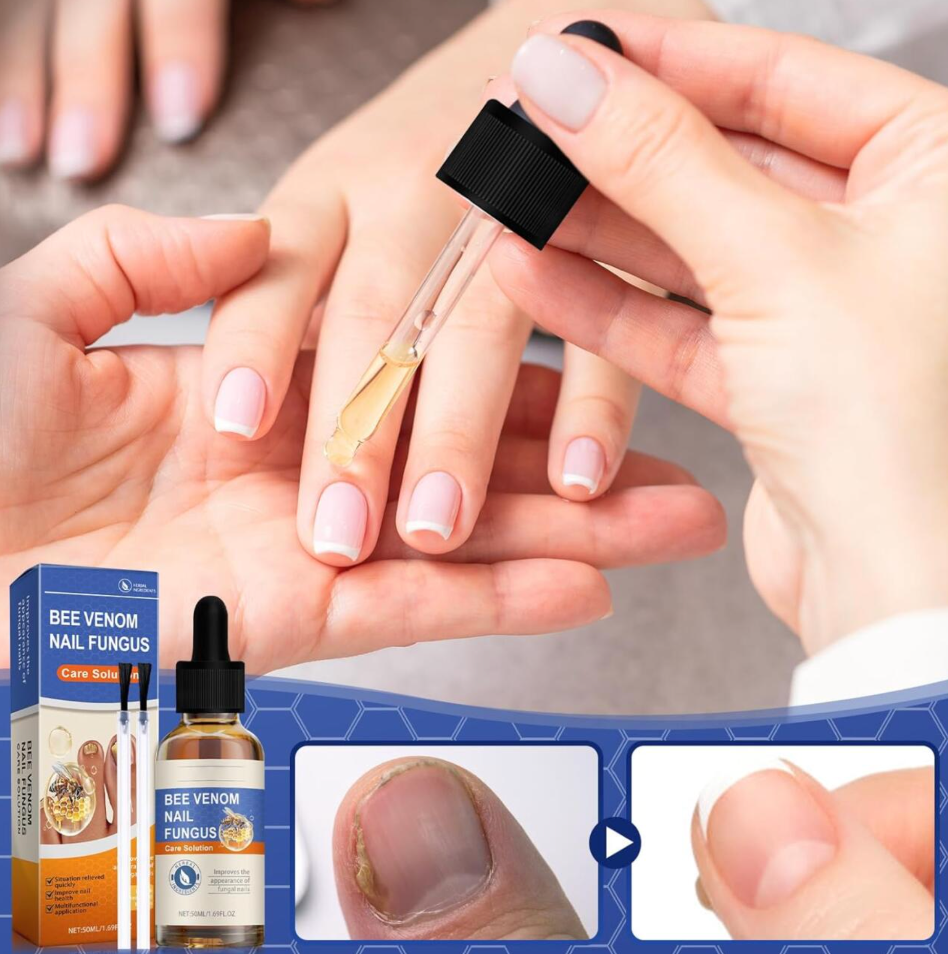 Serum de Veneno de Abeja para Uñas